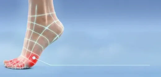 Calli e duroni ai piedi