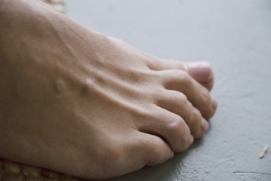 Perché le unghie dei piedi diventano gialle? Le cause e i rimedi
