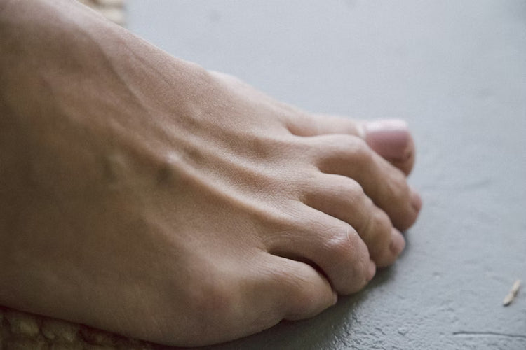 Perché le unghie dei piedi diventano gialle? Le cause e i rimedi