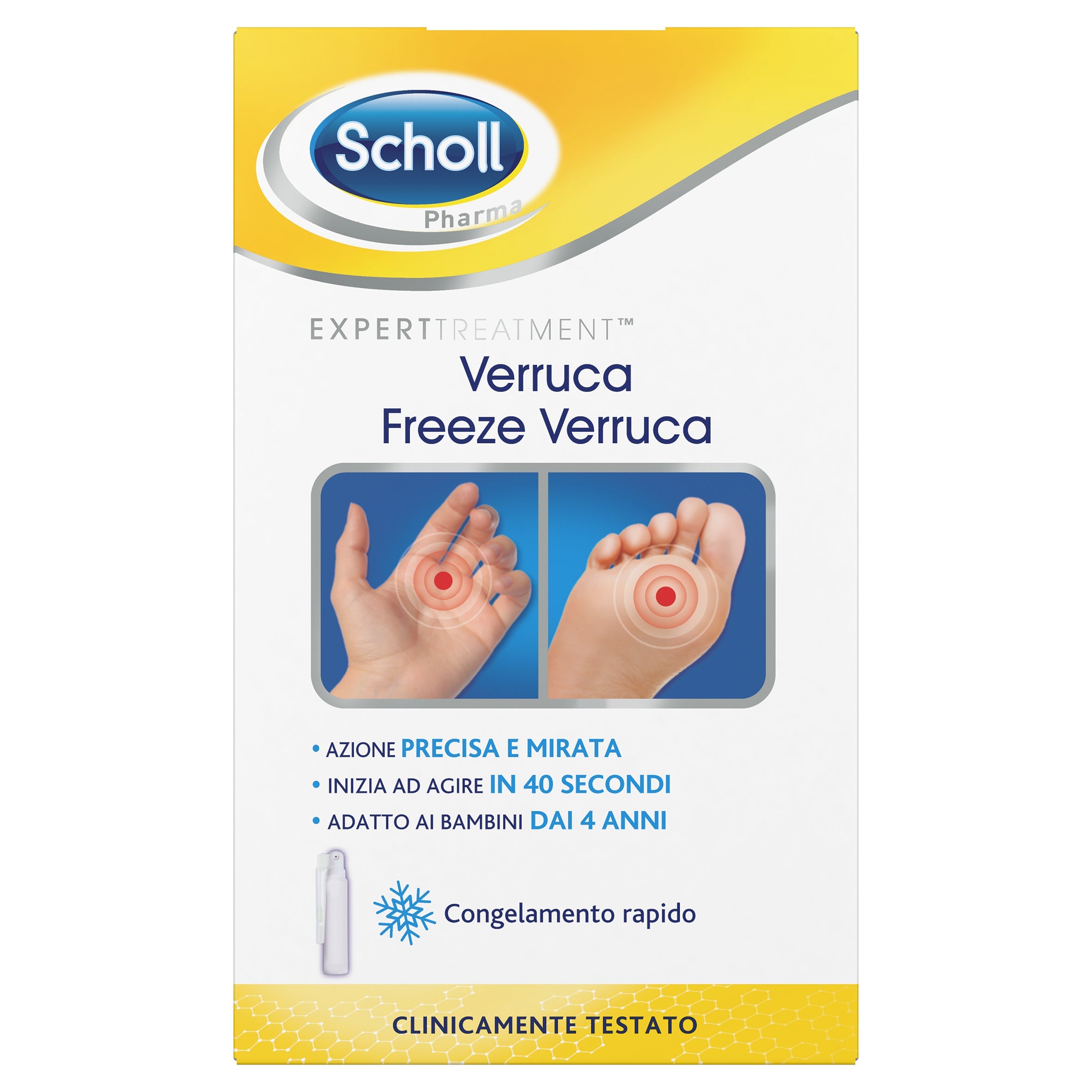 Freeze Verruca